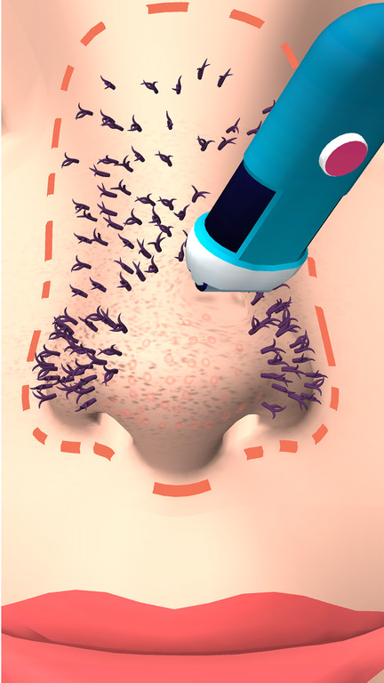 干净的鼻子 干净的鼻子