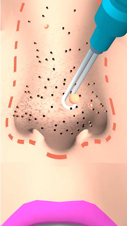 干净的鼻子 干净的鼻子