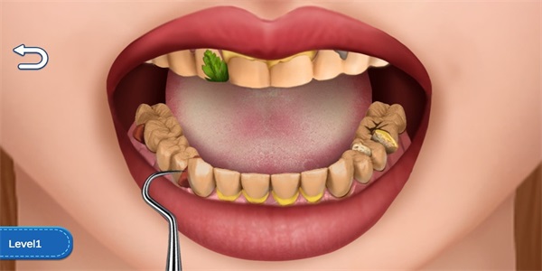 清洁牙齿狂热(Clean Teeth Craze)